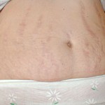 strii1_-150x150